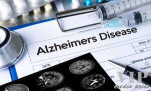САЩ одобриха ново лекарство за Алцхаймер